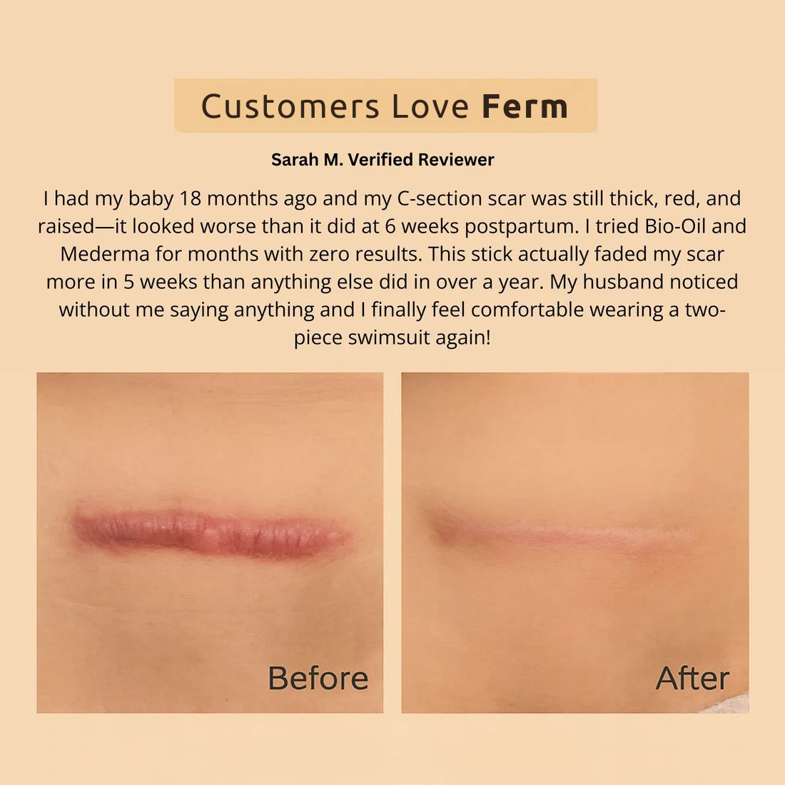 Medical Grade Scar & Wrinkle Stick